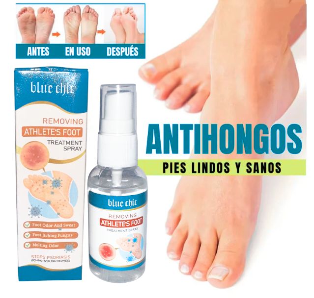 Spray AntiHongos