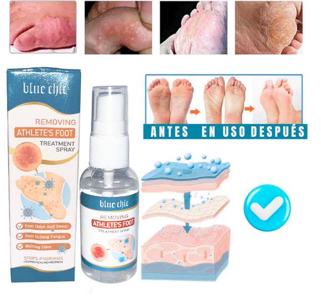 Spray AntiHongos