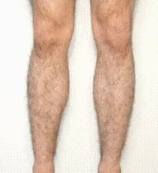Crema Depilatoria Suave y Efectiva