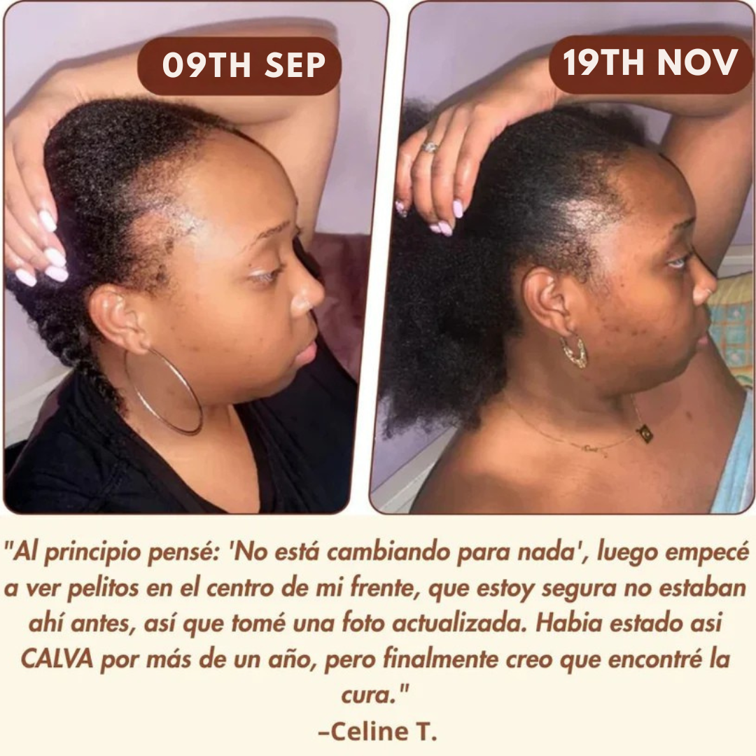 Batana Oil Cream - Tratamiento Capilar contra la Caída del Cabello