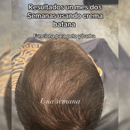 Batana Oil Crescimiento Natural Poderoso