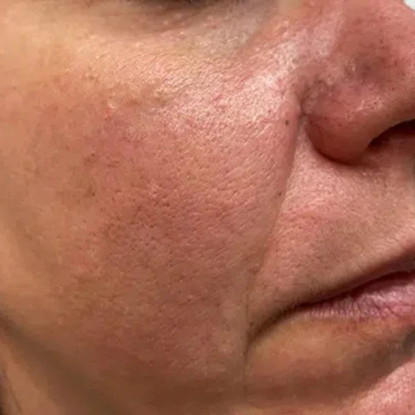 Suero Milagroso para la Piel