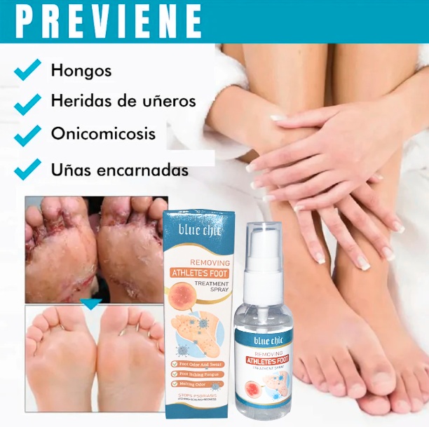 Spray AntiHongos
