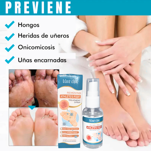 Spray AntiHongos