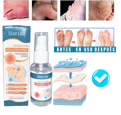 Spray AntiHongos