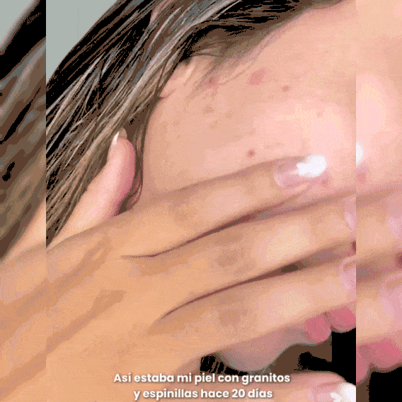 Serum Hidratante para Piel Radiante