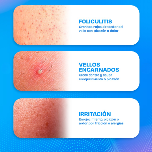 Aceite Íntimo Piel Radiante Suave