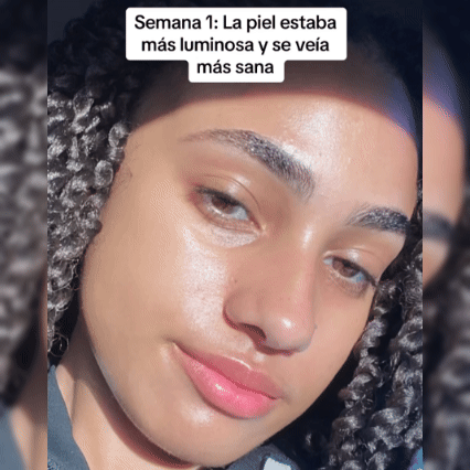 Suero Milagroso para la Piel