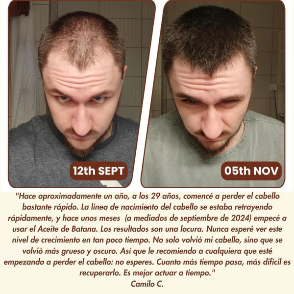 Batana Oil Crescimiento Natural Poderoso